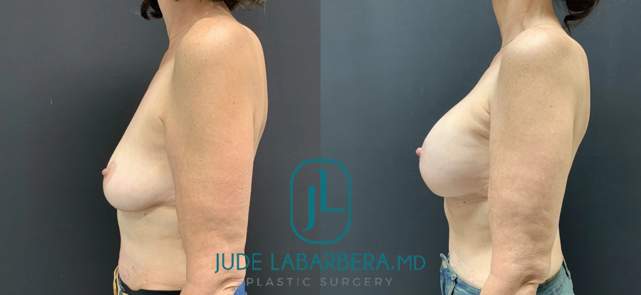 eZy Watermark_31-01-2024_09-33-25-1770AM