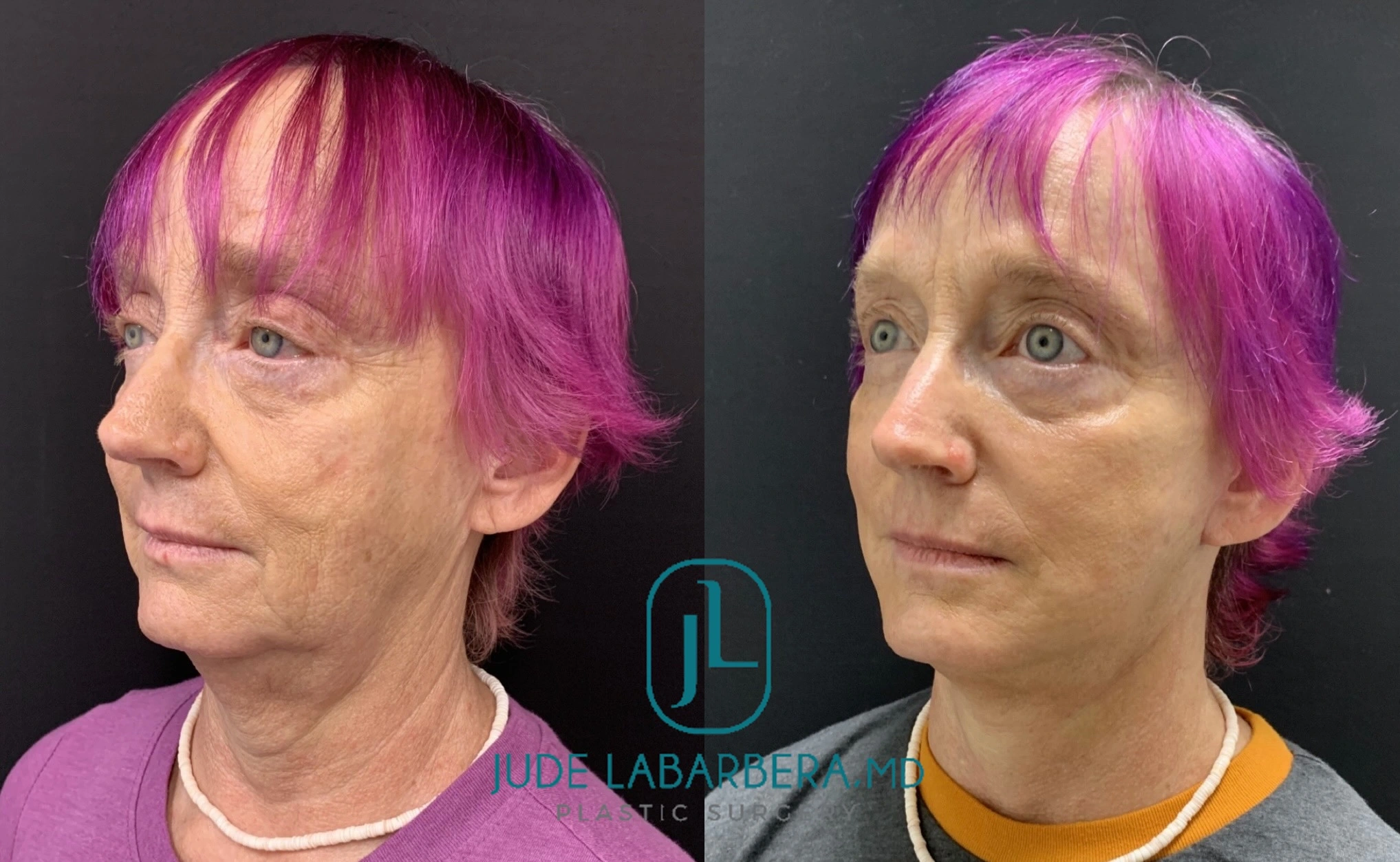 eZy Watermark_31-07-2024_03-40-05-6040PM