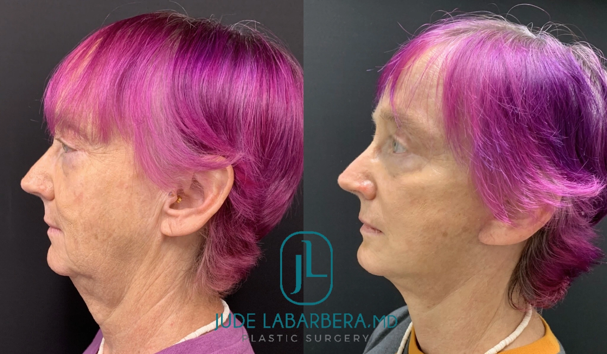 eZy Watermark_31-07-2024_03-40-20-3310PM