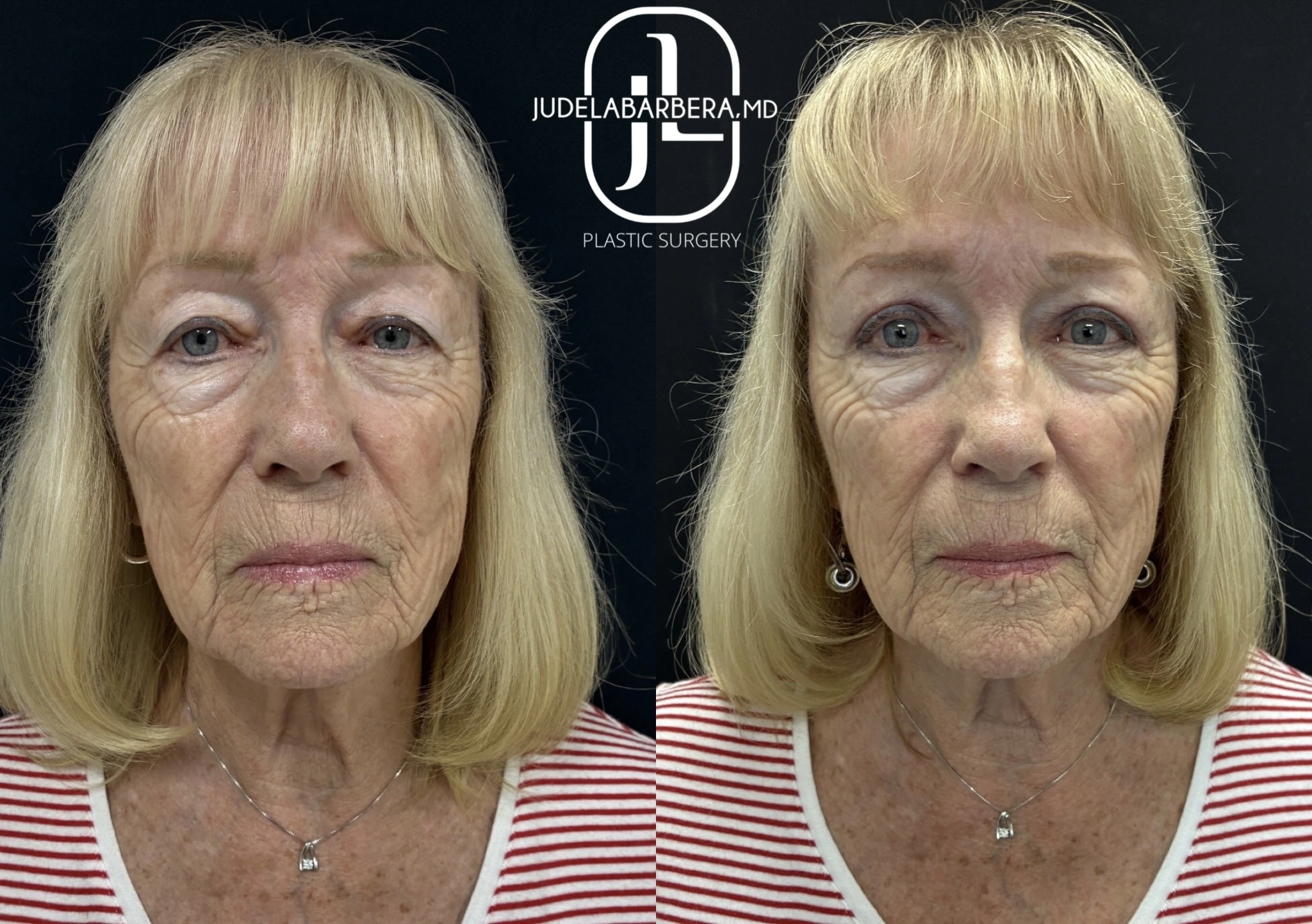 eZy Watermark_20-11-2025_01-04-28-5220PM