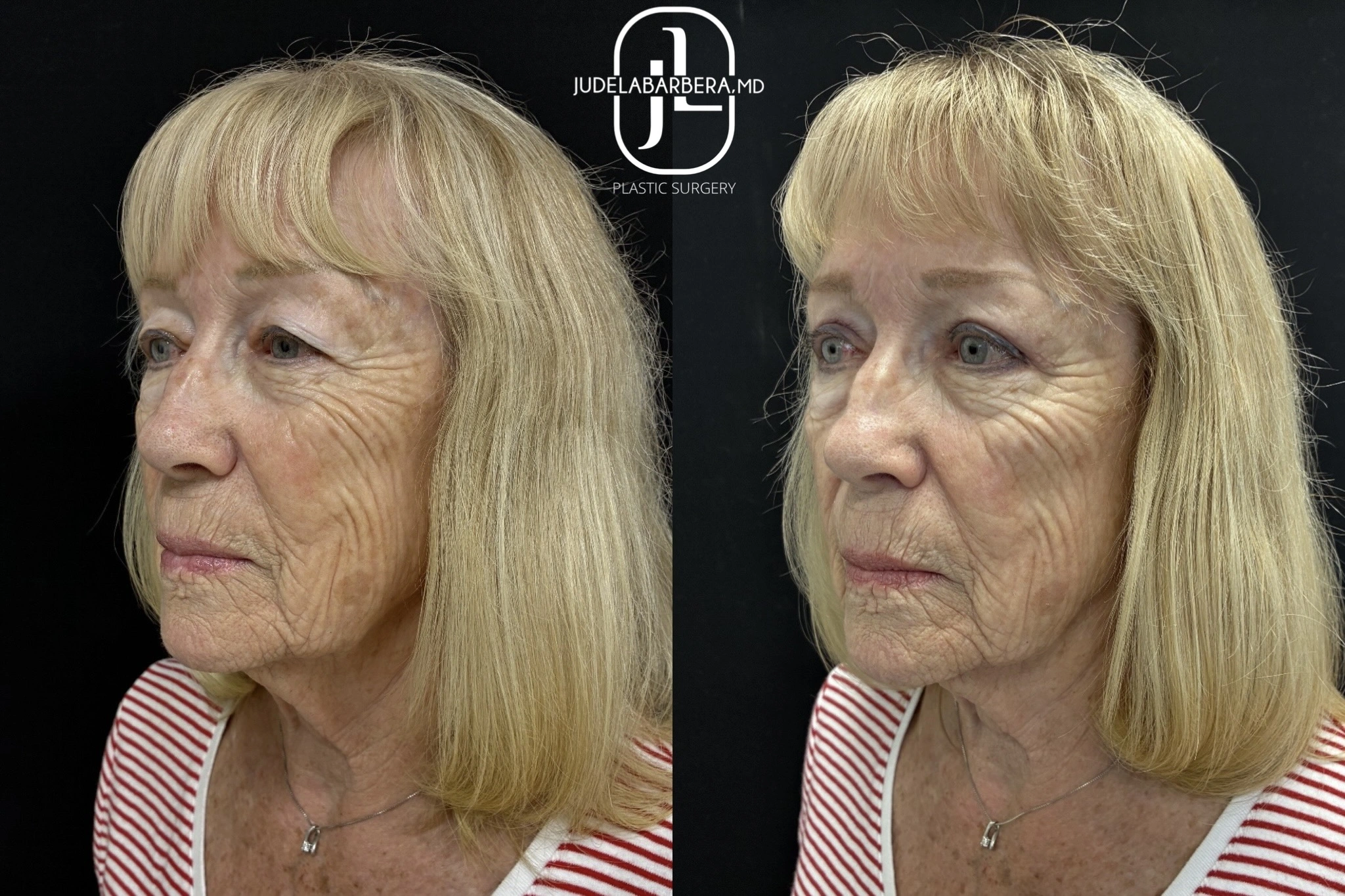 eZy Watermark_20-11-2025_01-04-51-6940PM