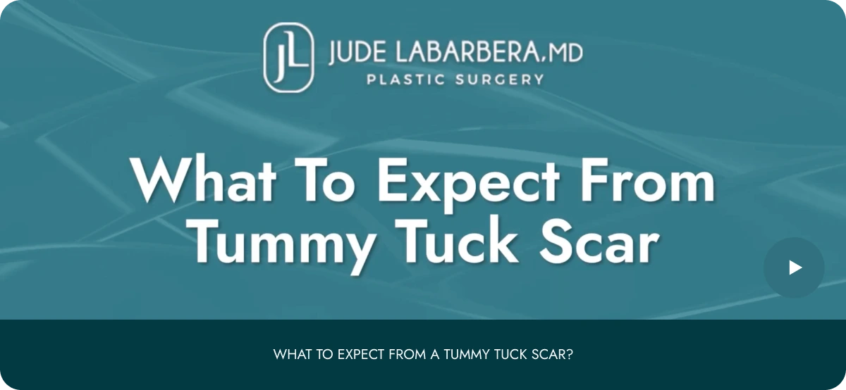 What to Expert from Tummy Tuck scar Banner