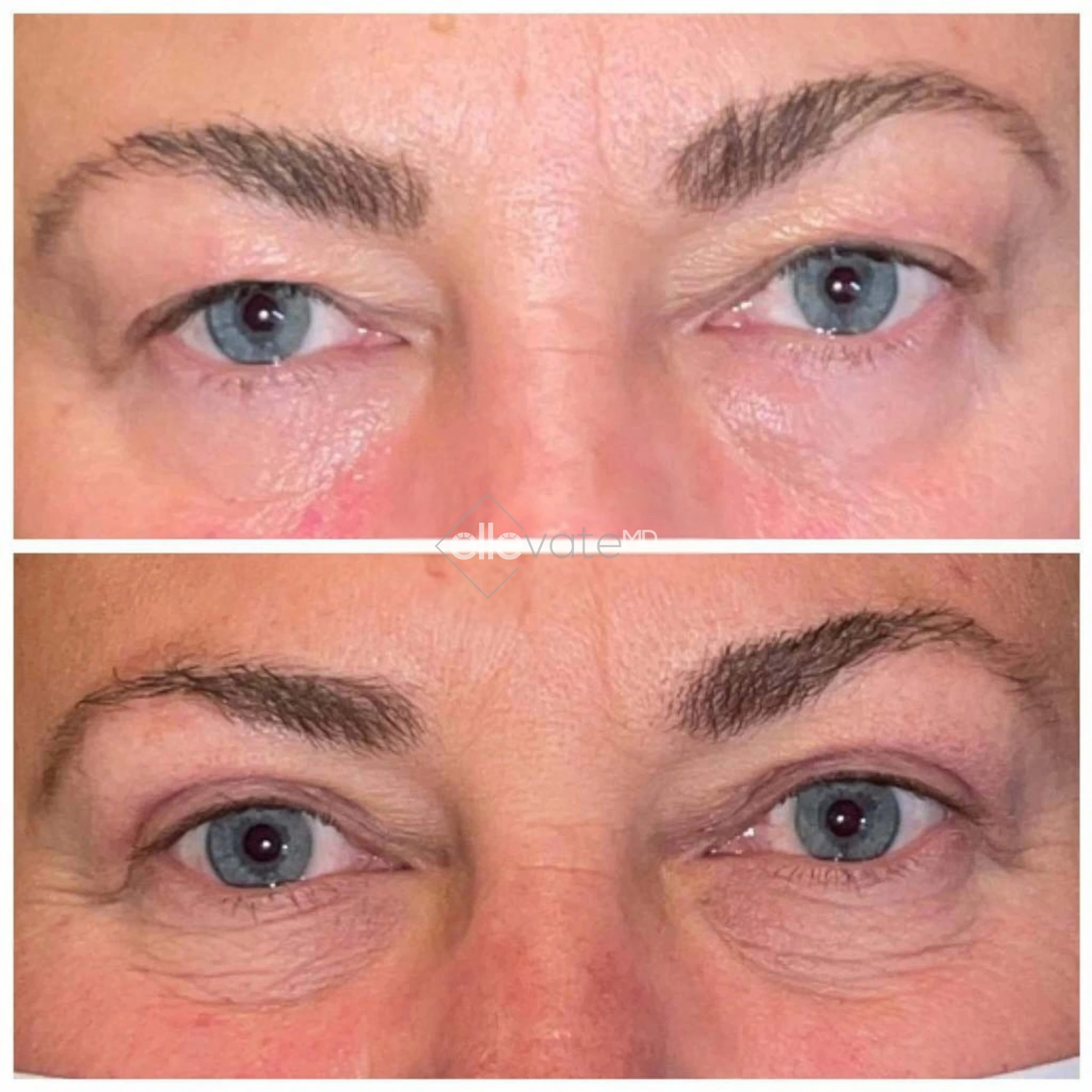 ellevate - 2025-03-22T153215.986