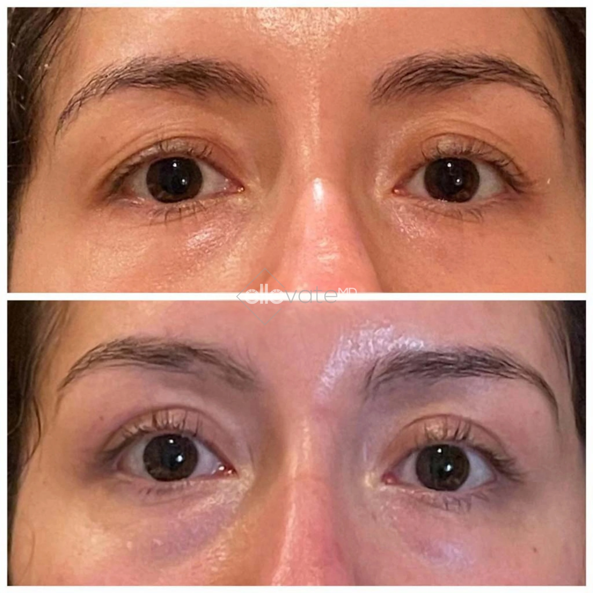 ellevate - 2025-03-22T155539.491