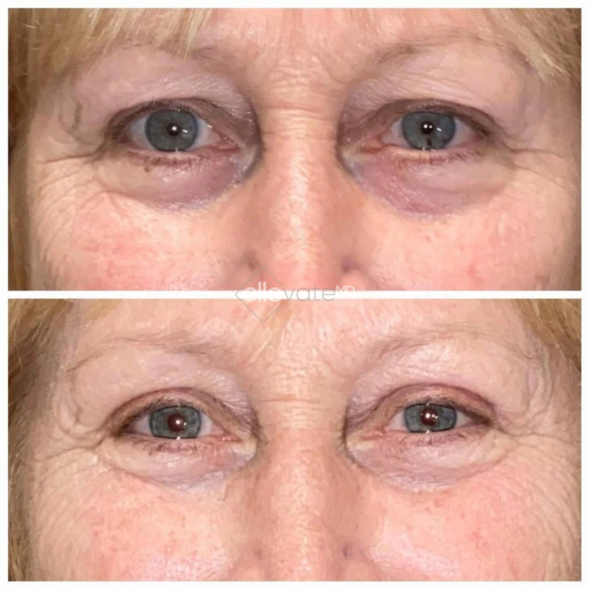 ellevate - 2025-03-22T162851.890