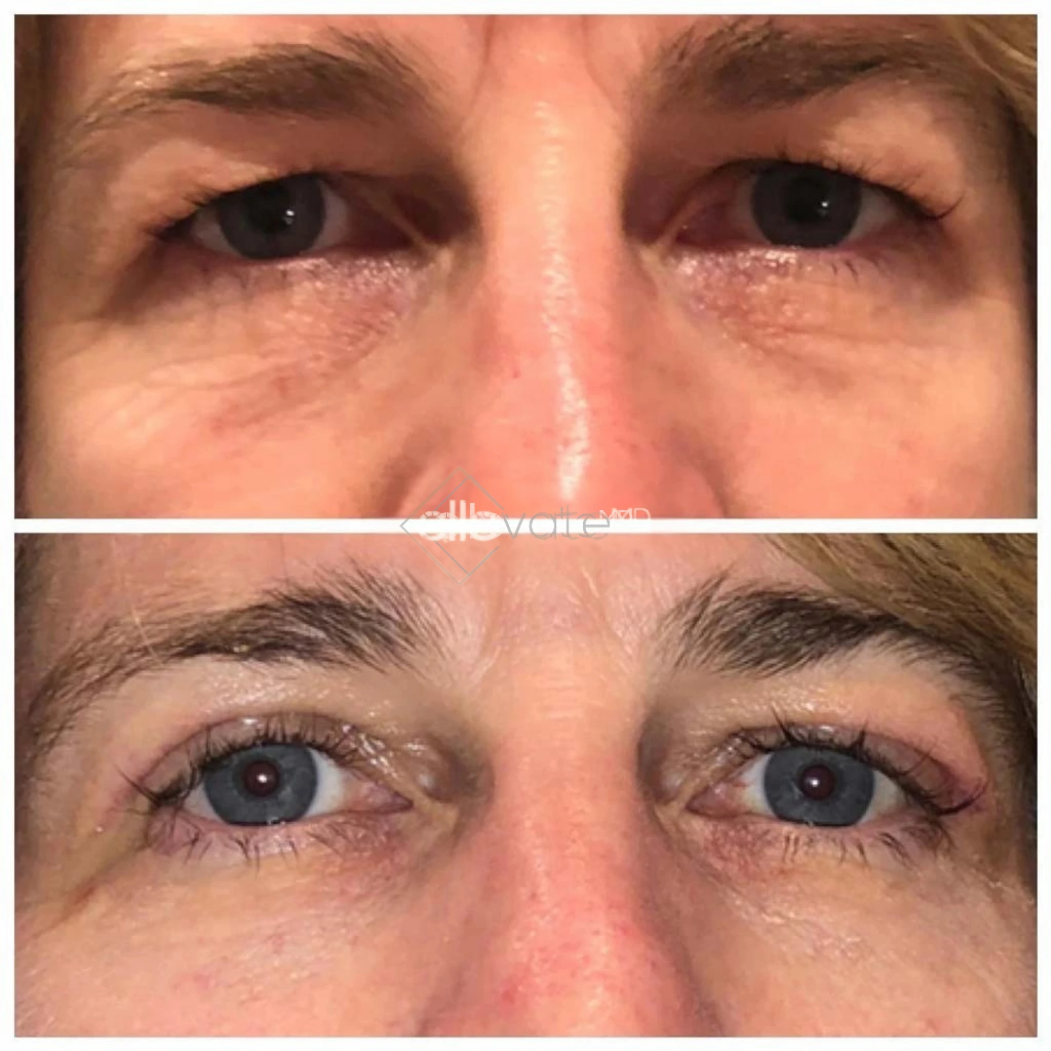 ellevate - 2025-03-22T165908.029