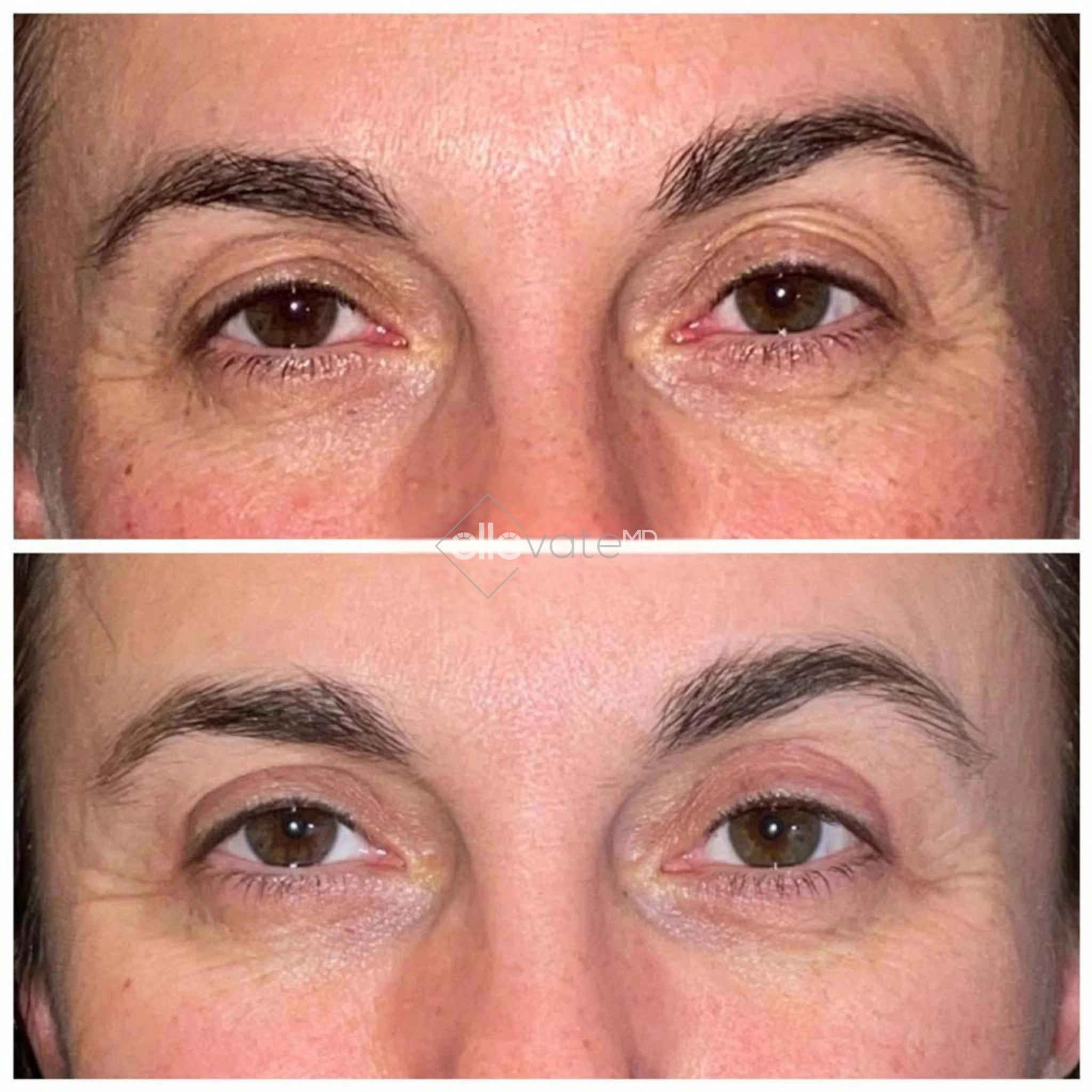 ellevate - 2025-03-22T173205.239