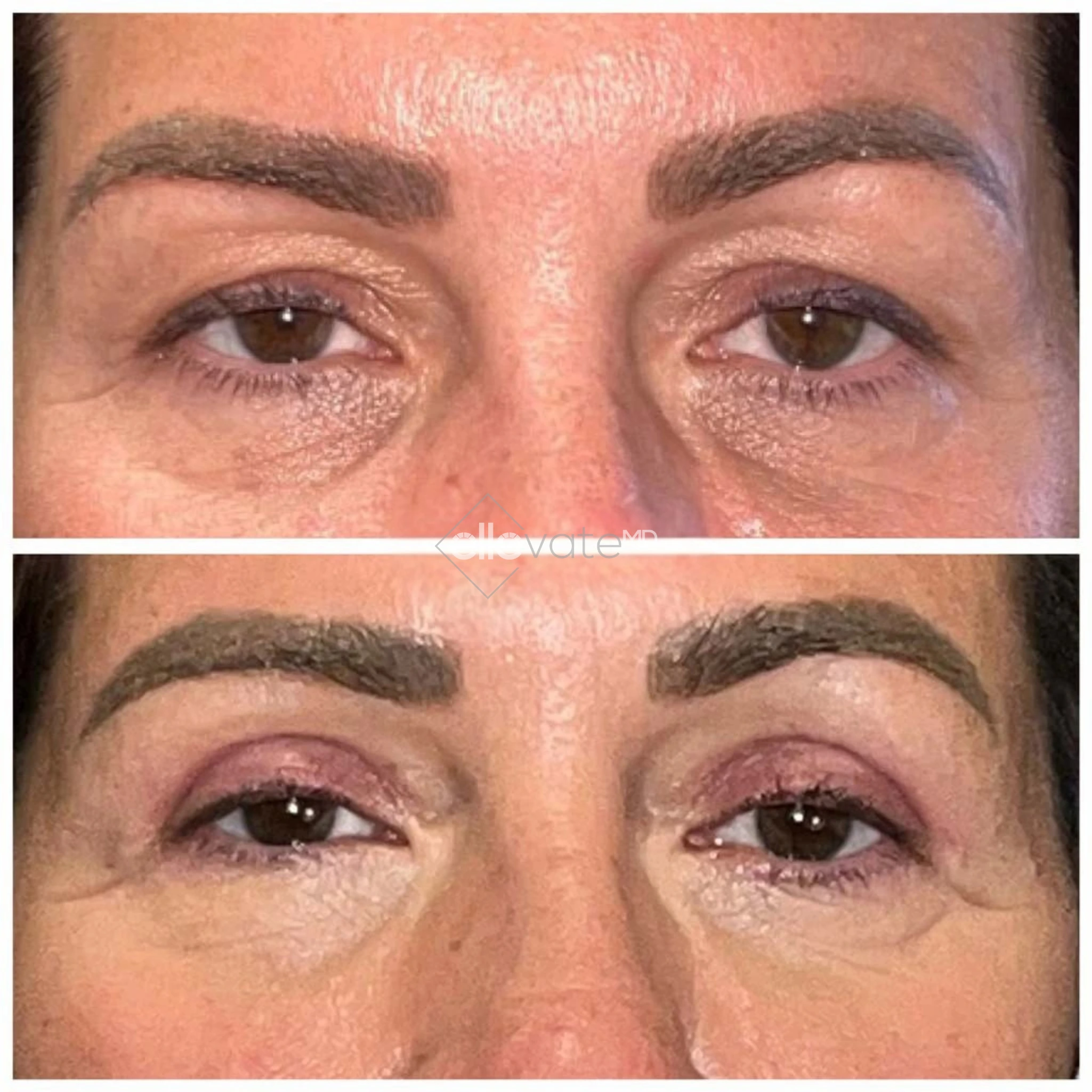 ellevate - 2025-03-22T184306.055