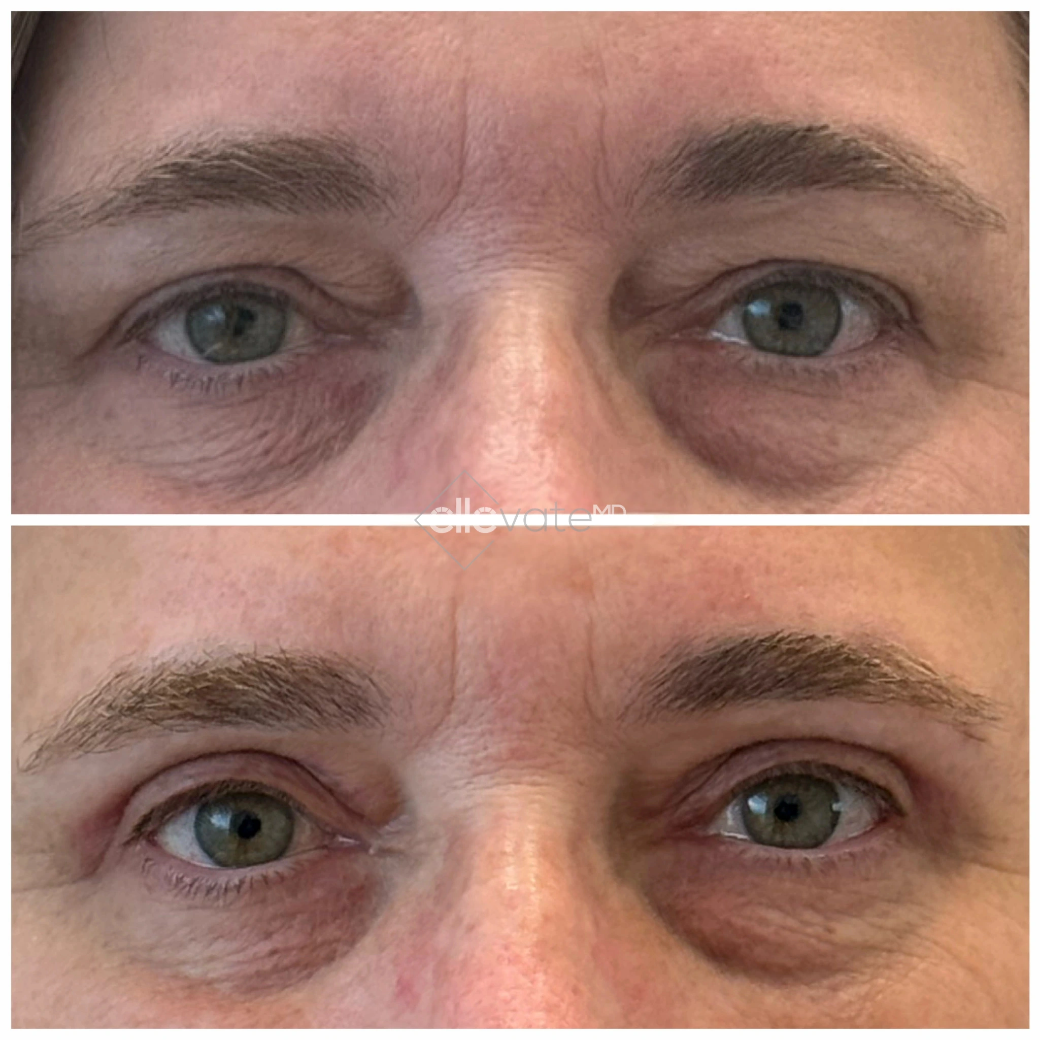 ellevate - 2025-03-22T185912.734