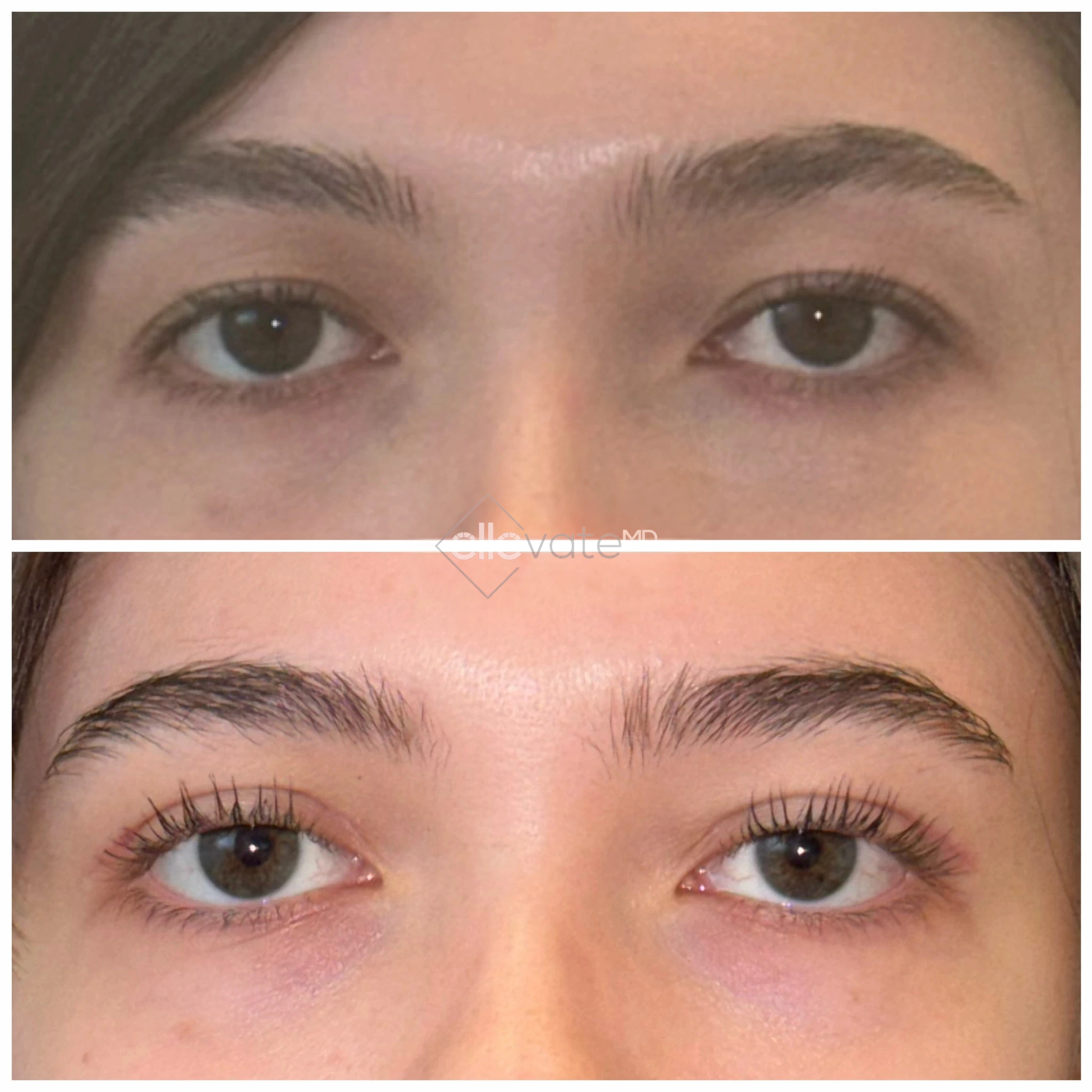 ellevate - 2025-03-22T190536.695