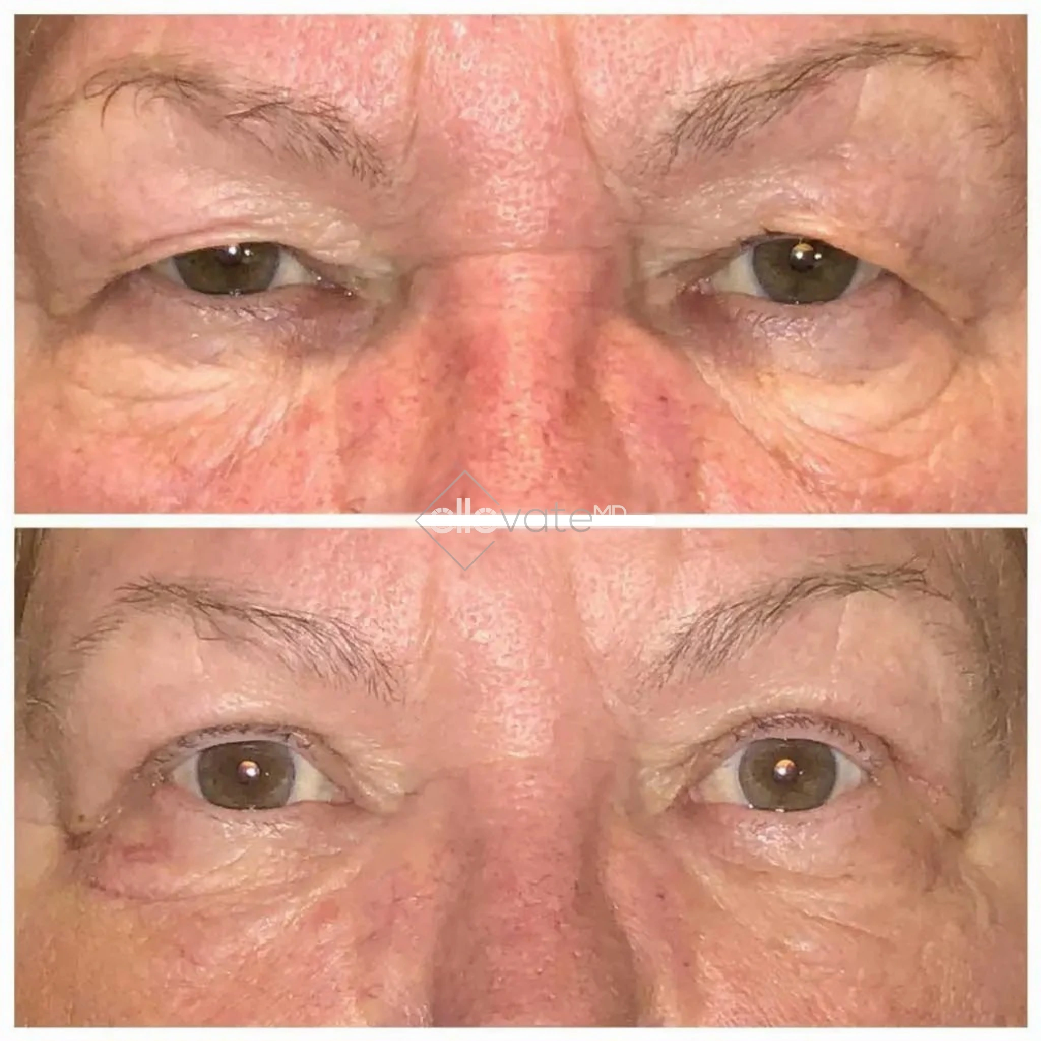 ellevate - 2025-03-22T204621.965