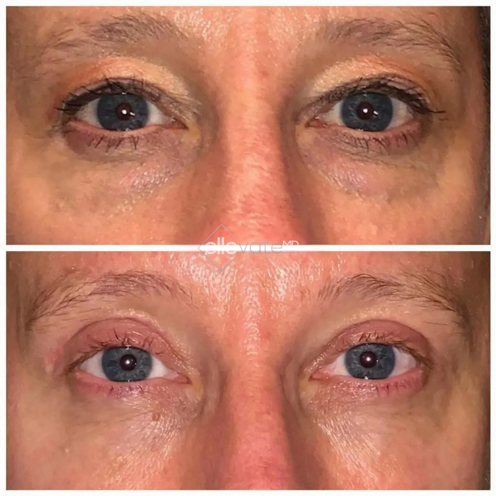 ellevate - 2025-03-22T233443.378