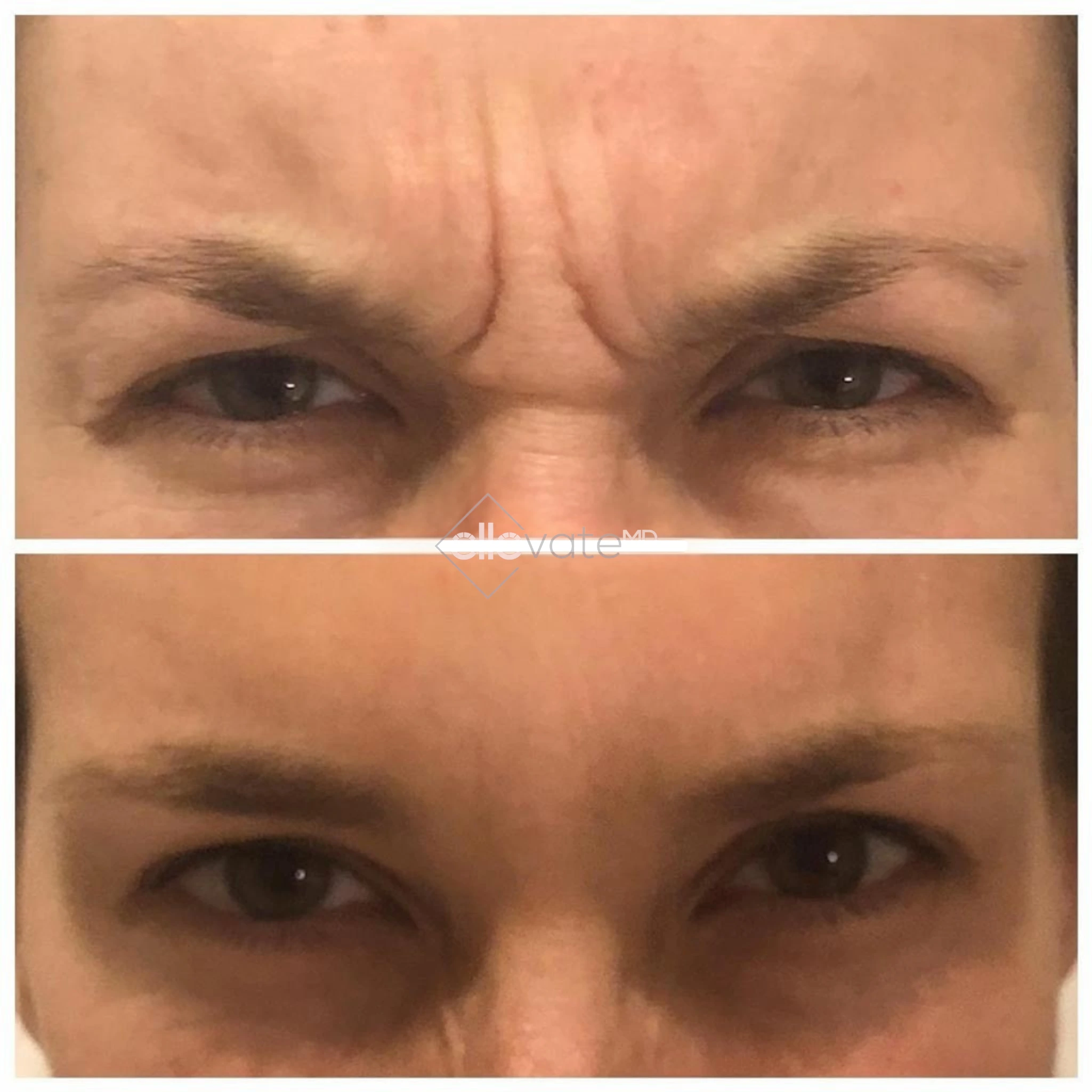 ellevate - 2025-03-23T103613.947