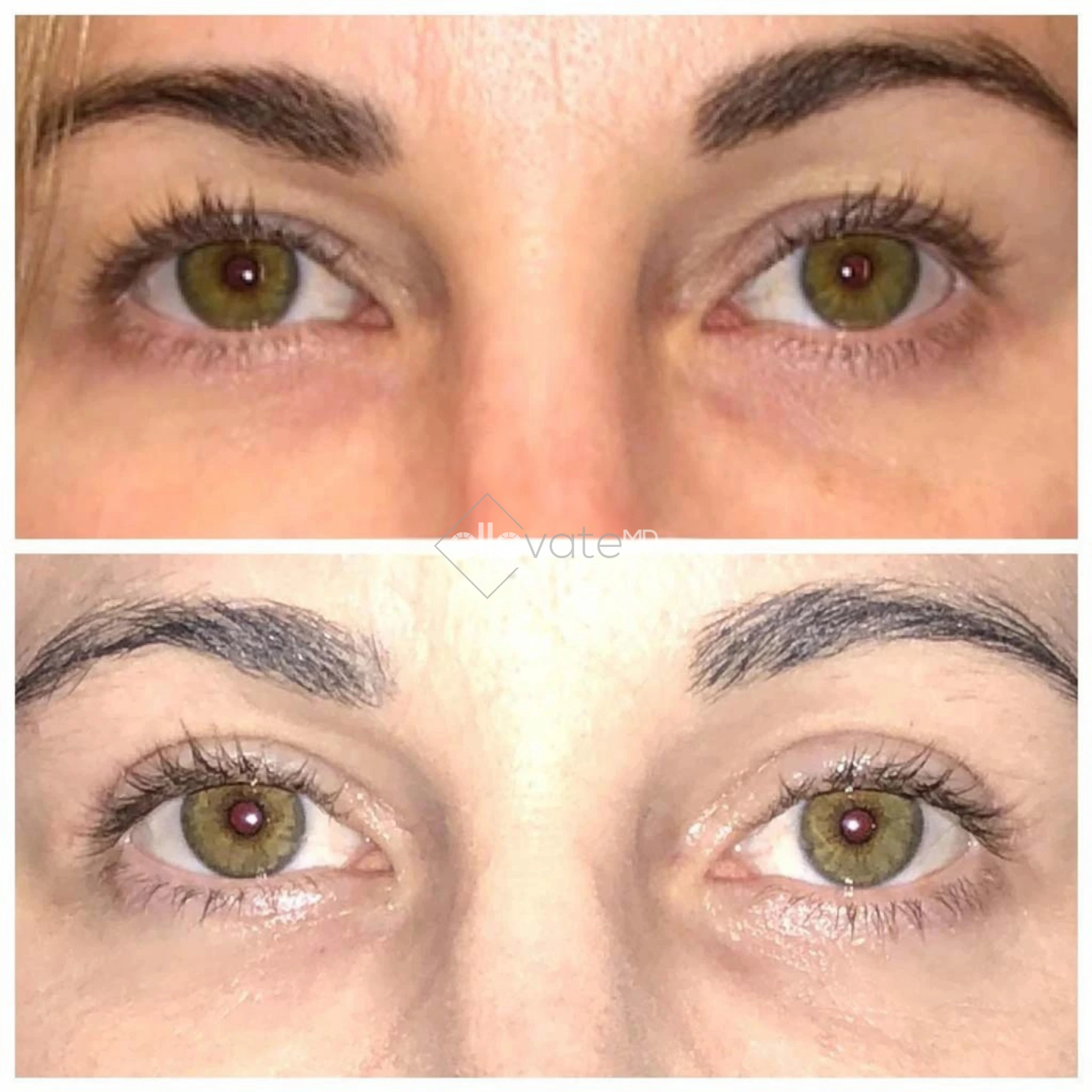 ellevate - 2025-03-23T111816.287