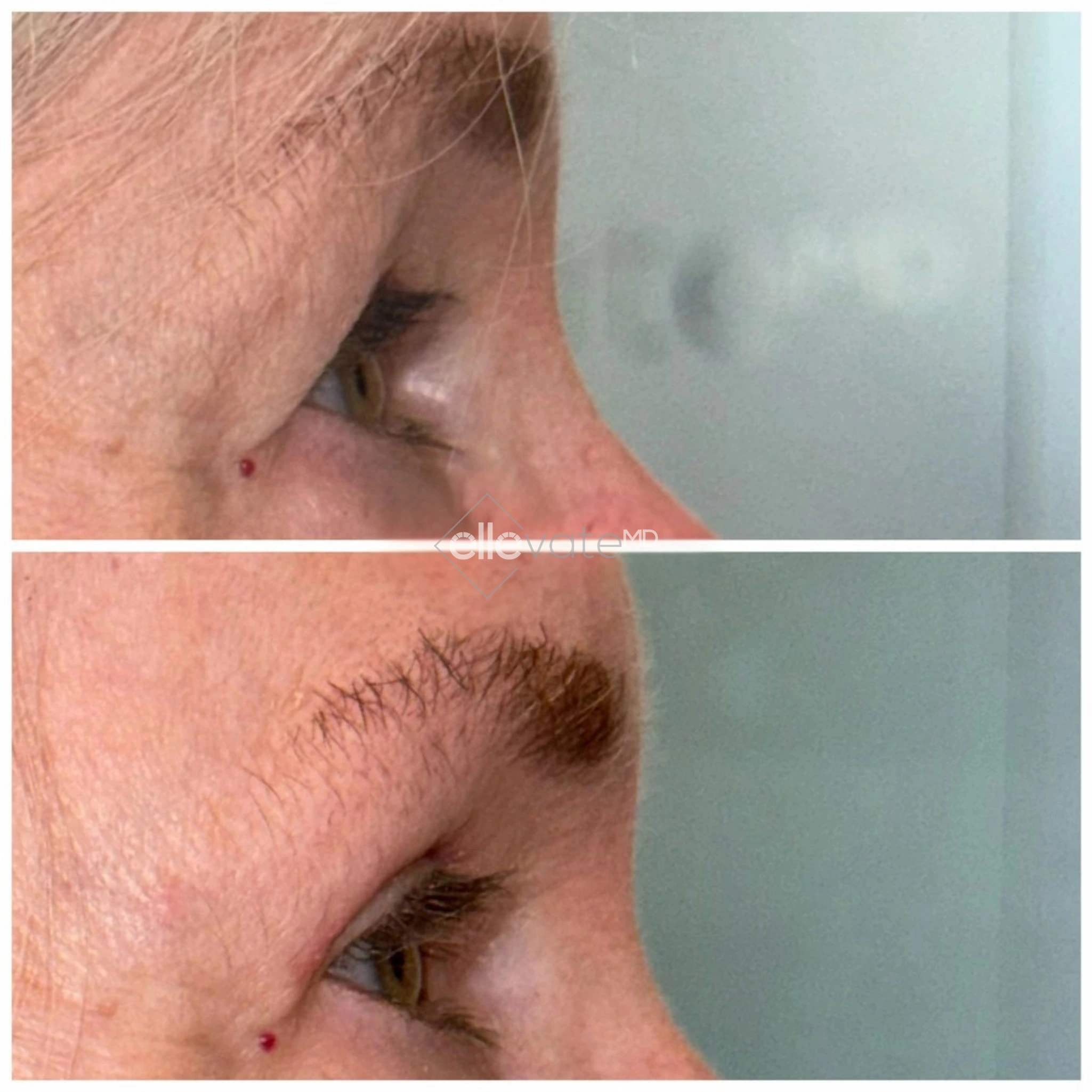 ellevate - 2025-03-23T114337.243