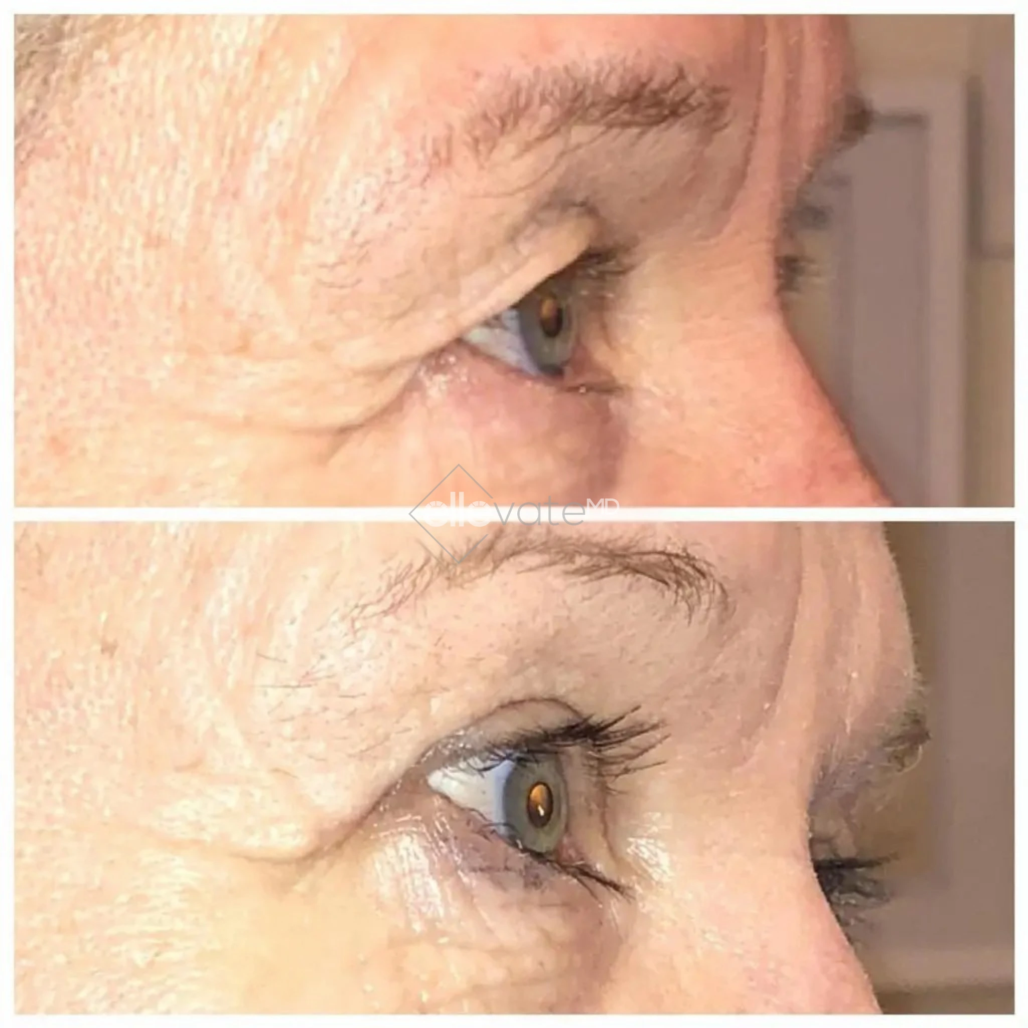 ellevate - 2025-03-23T115823.922