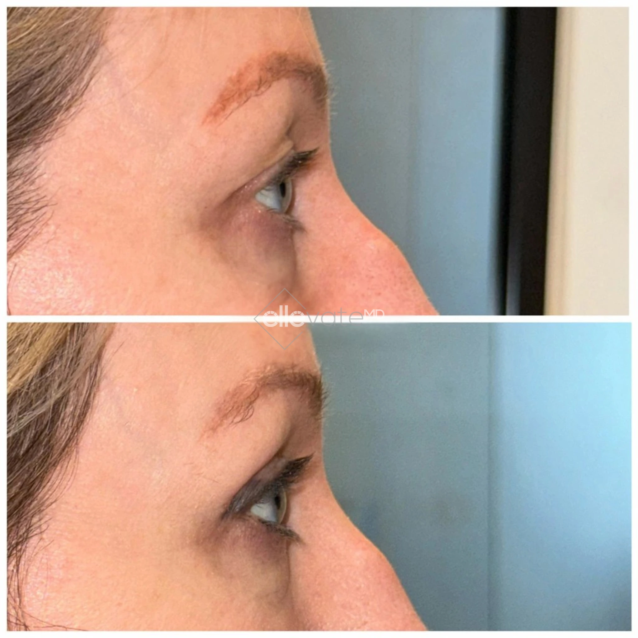 ellevate - 2025-03-23T123719.288