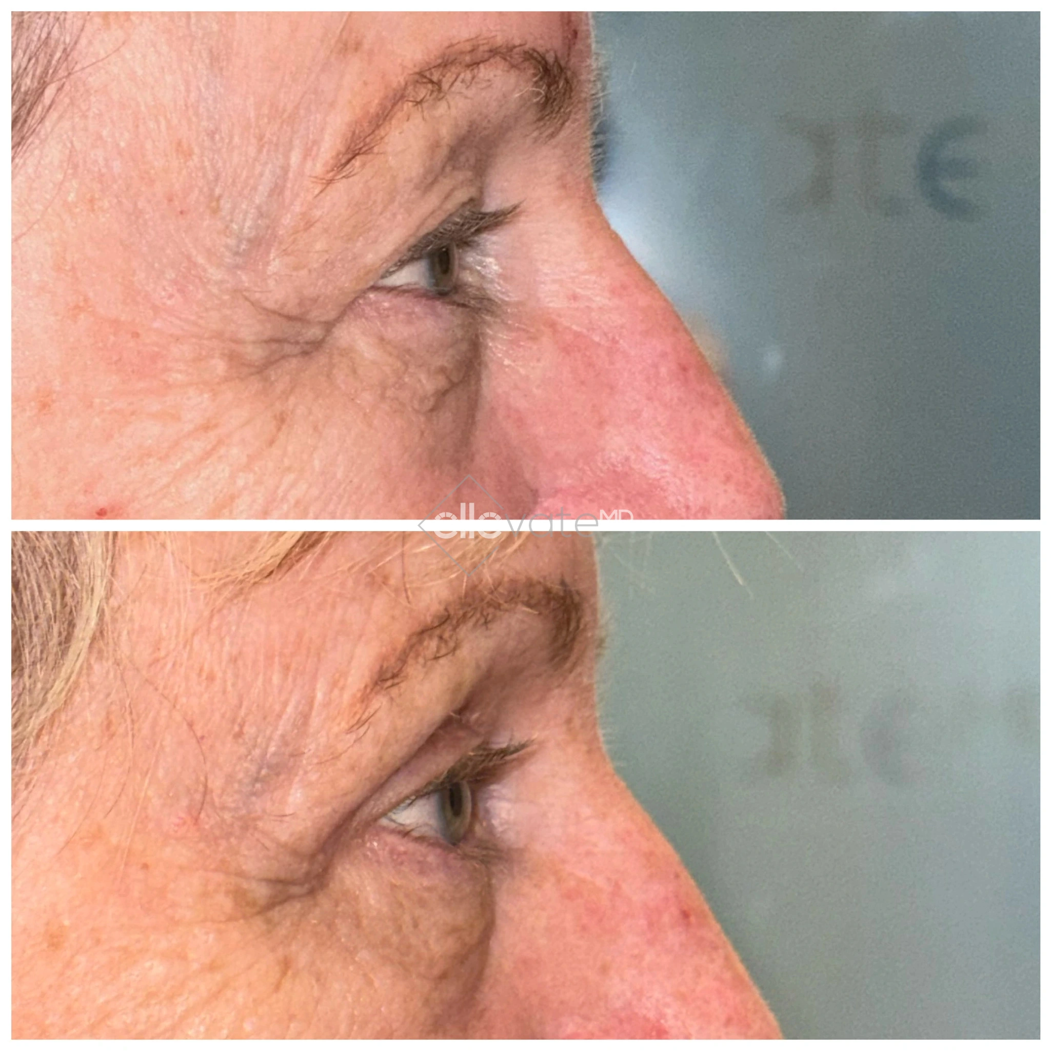 ellevate - 2025-03-23T124249.221