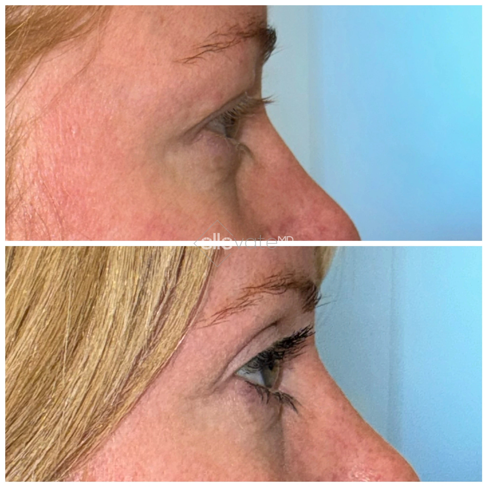 ellevate - 2025-03-23T124614.292