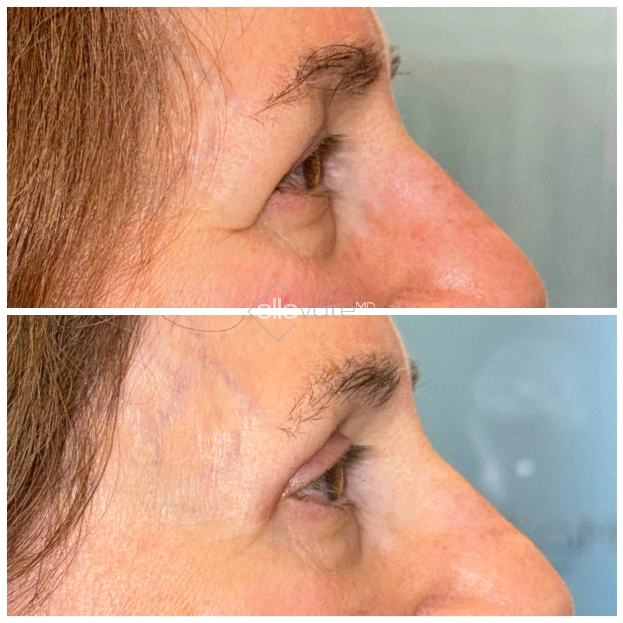 ellevate - 2025-03-23T124801.336