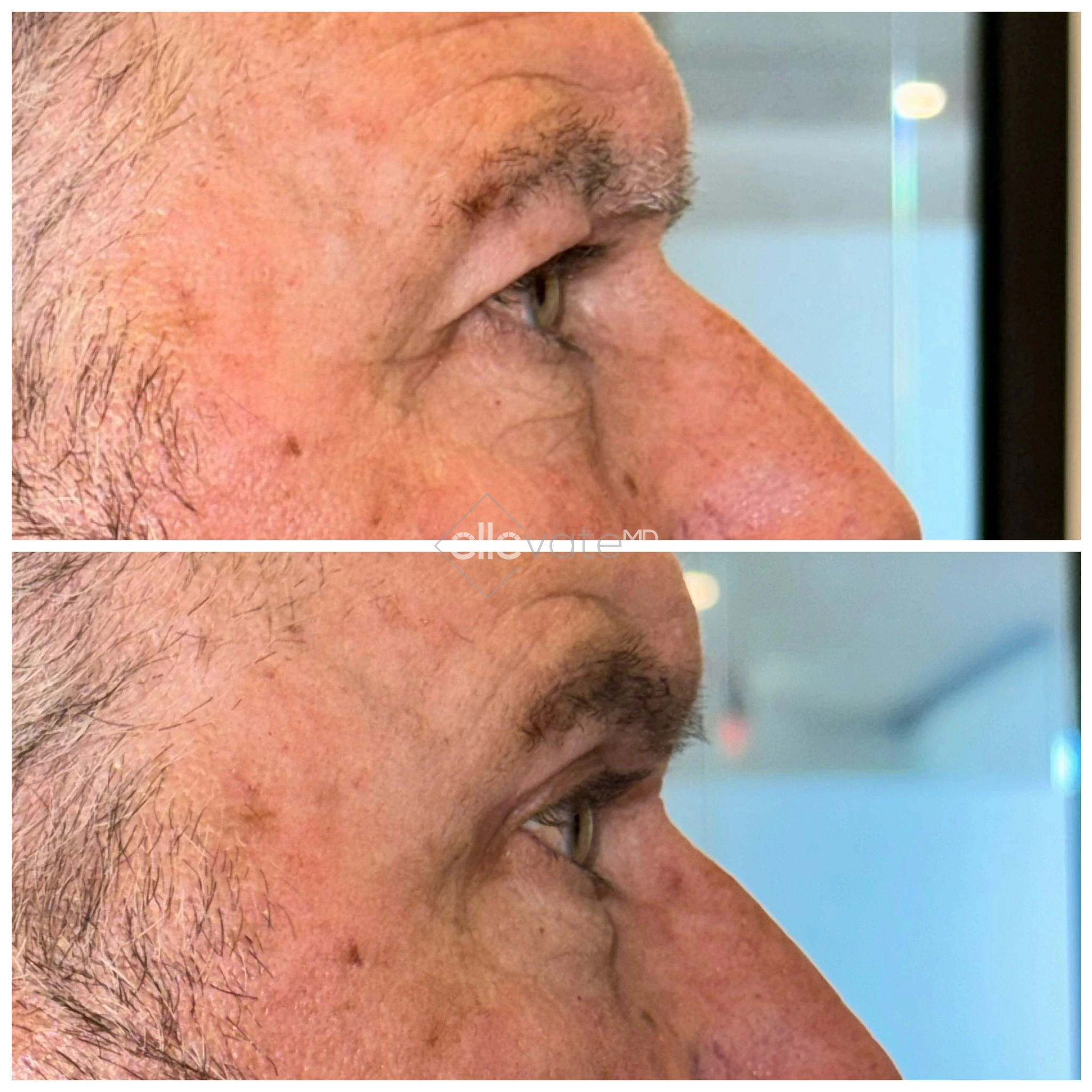 ellevate - 2025-03-23T125039.997