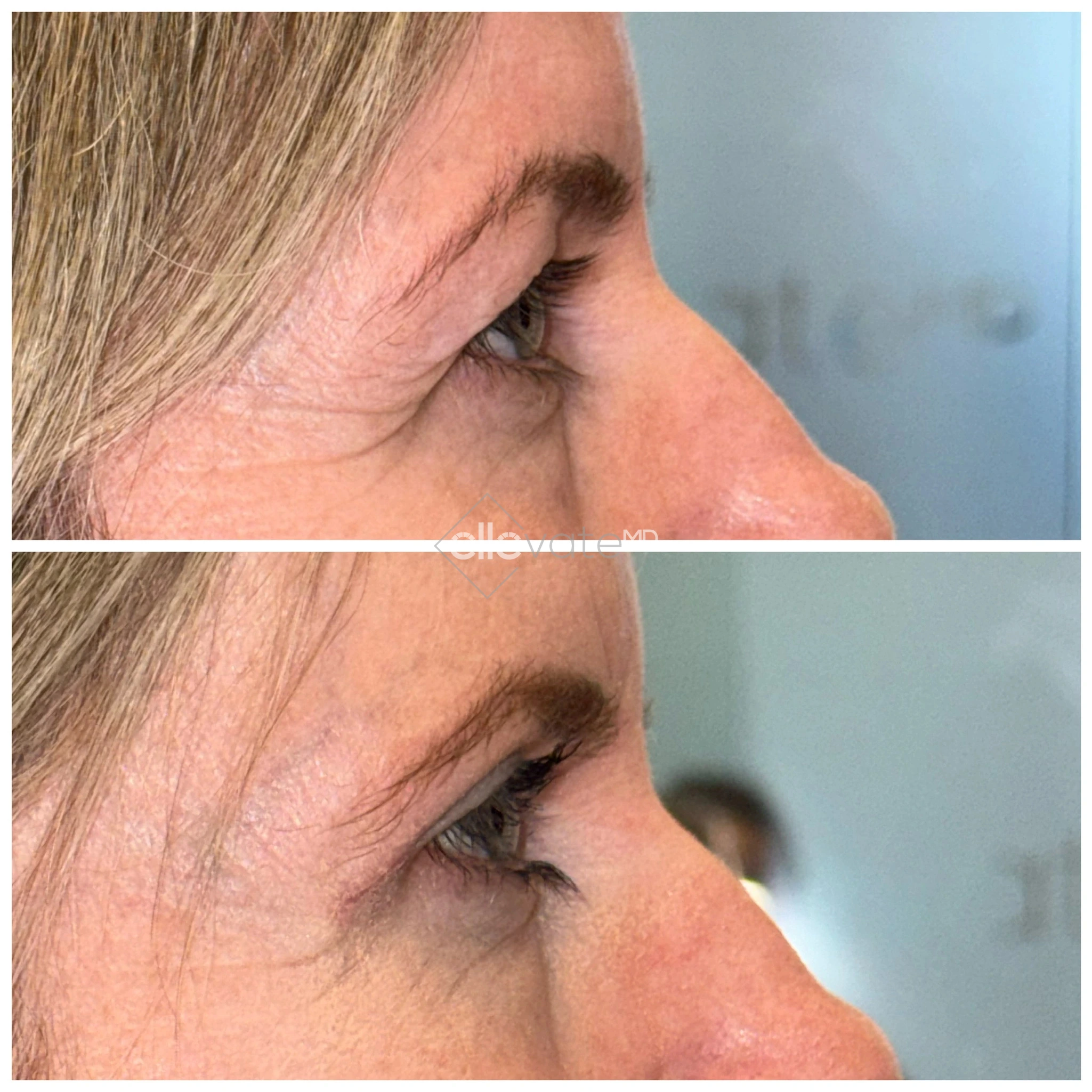 ellevate - 2025-03-23T125230.246