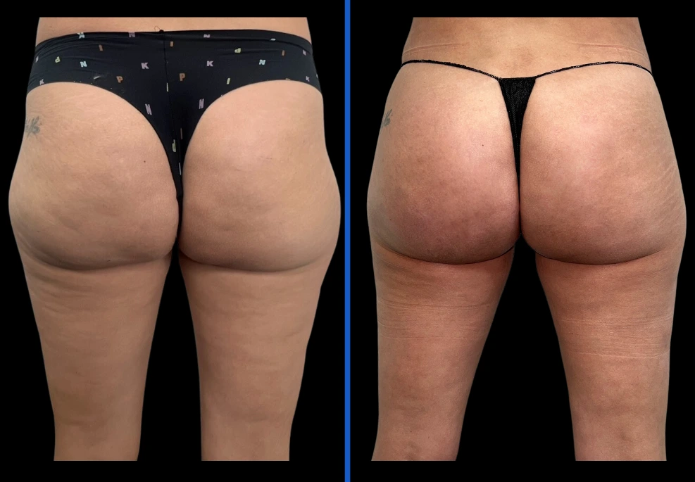 3aveli|Exertclinic