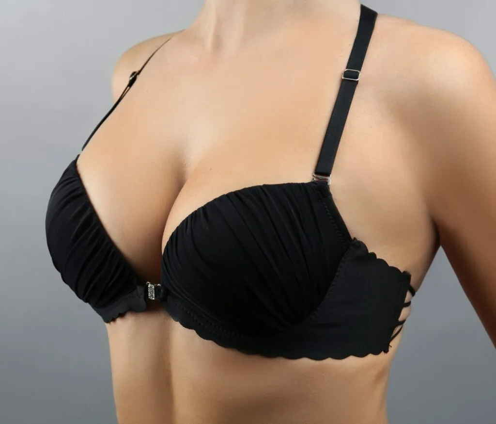 Make Sure That It's Armpit Fat, Not Axillary Breast Tissue Banner