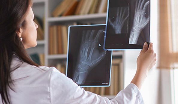 Shoulder to thumb pain - Xrays or MRI