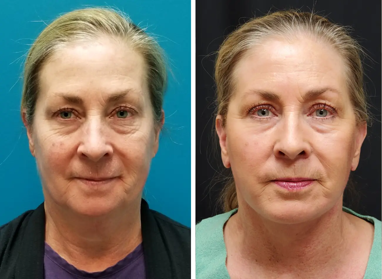 Untitled design (12)