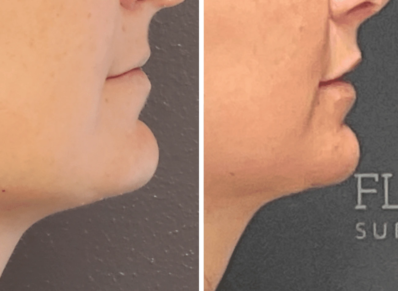 Untitled design (68)