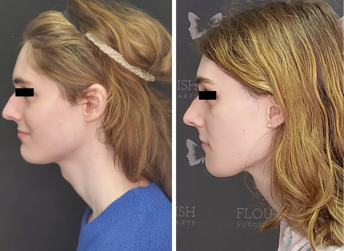 Untitled design (77)