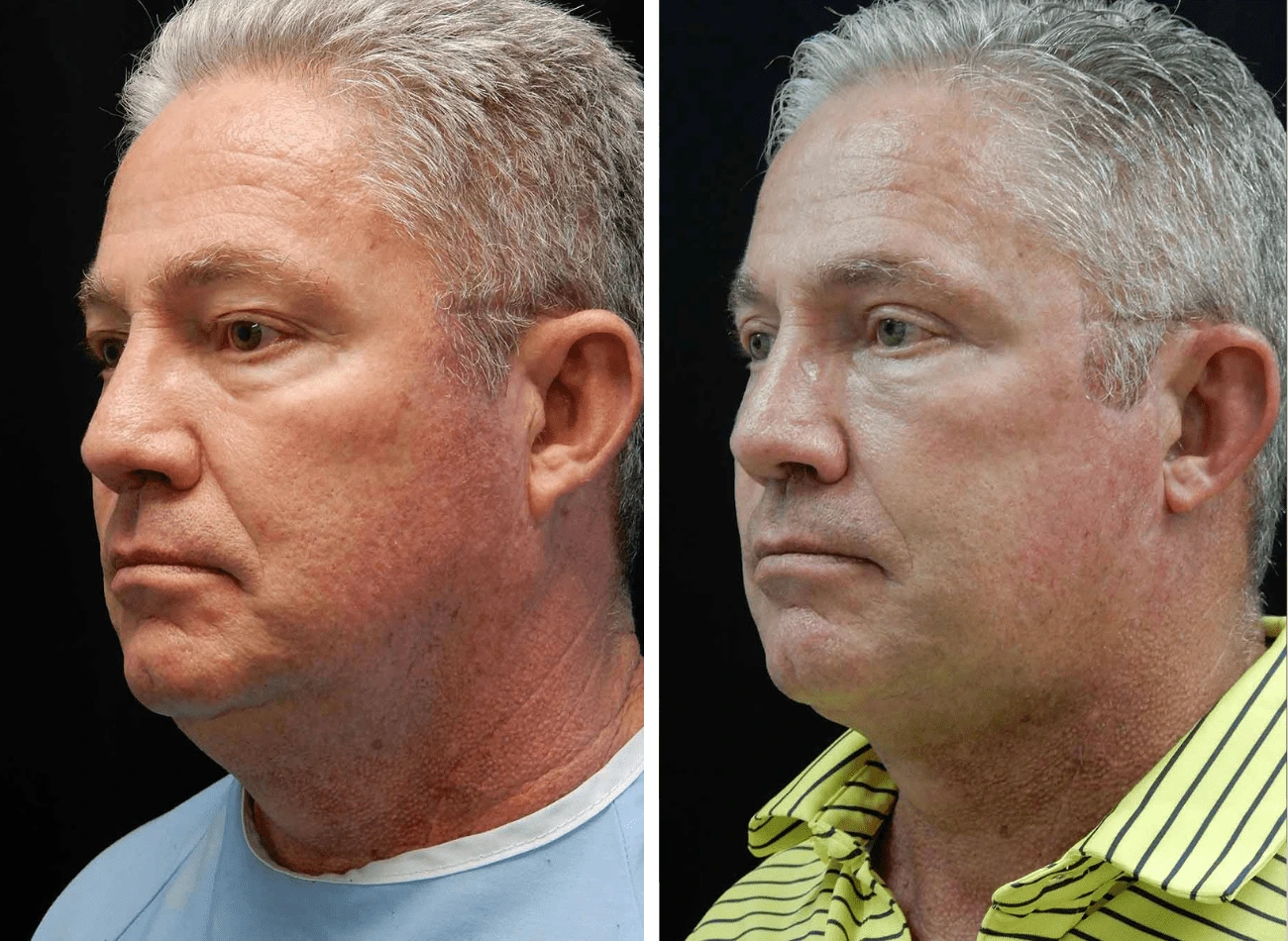 Untitled design (11)