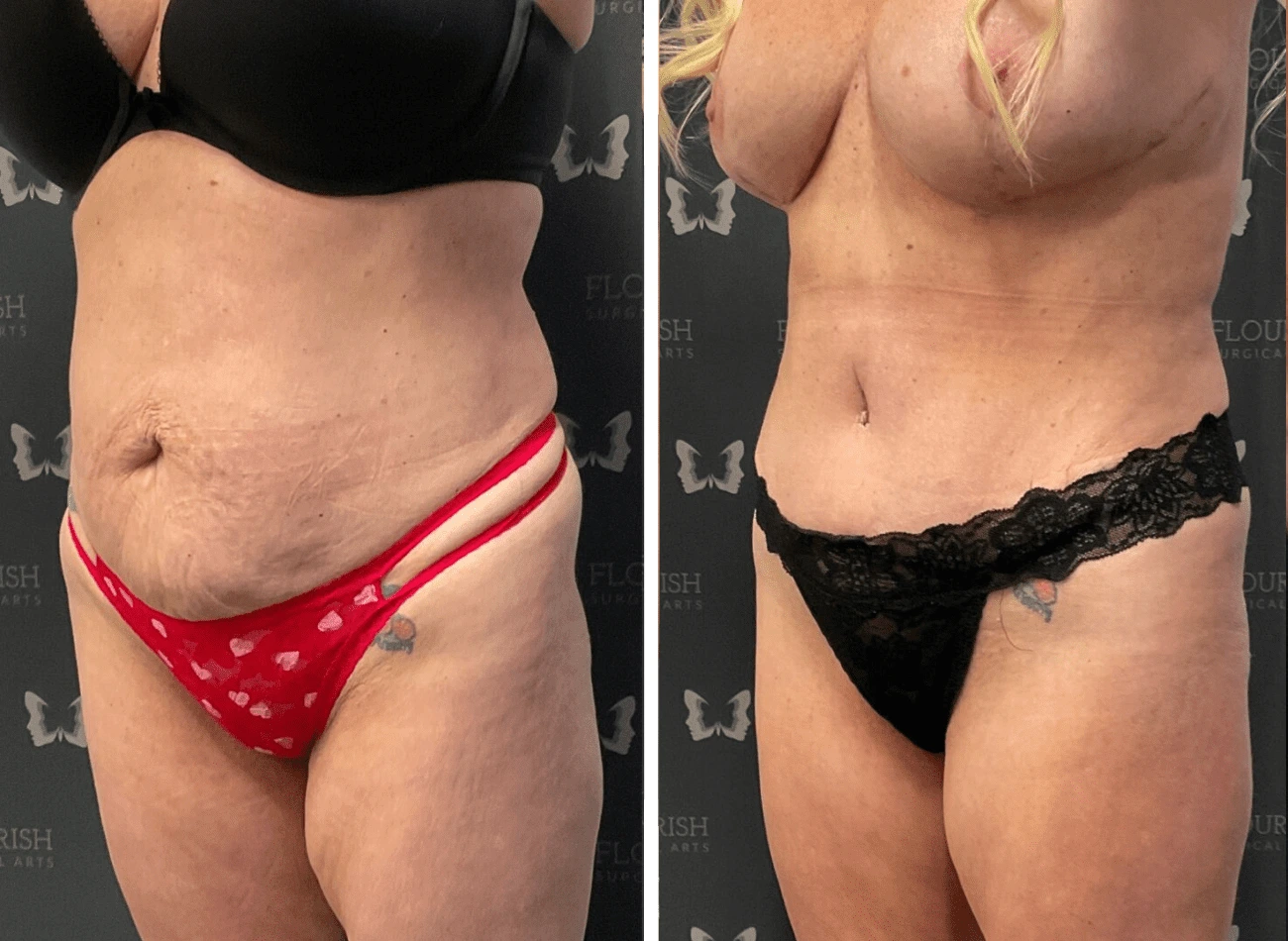 Untitled design (46)