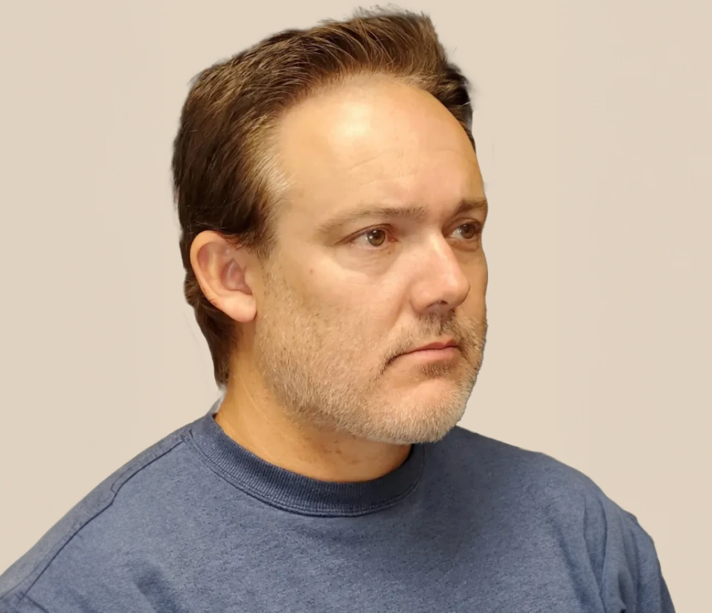 What Is Neck Lift? Banner