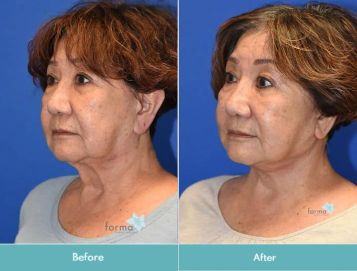 Untitled design (18)