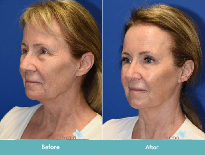 Untitled design (21)