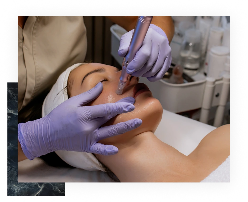 Microneedling in Scottsdale, AZ Banner