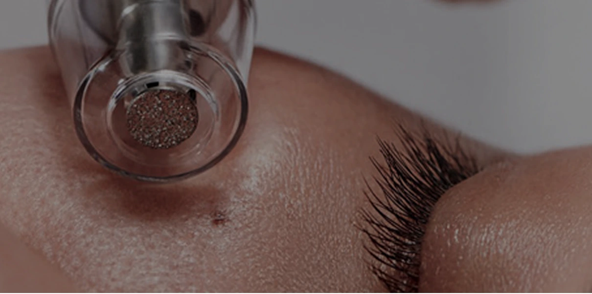 Diamond Glow facial device applicator with diamond-textured tip on skin