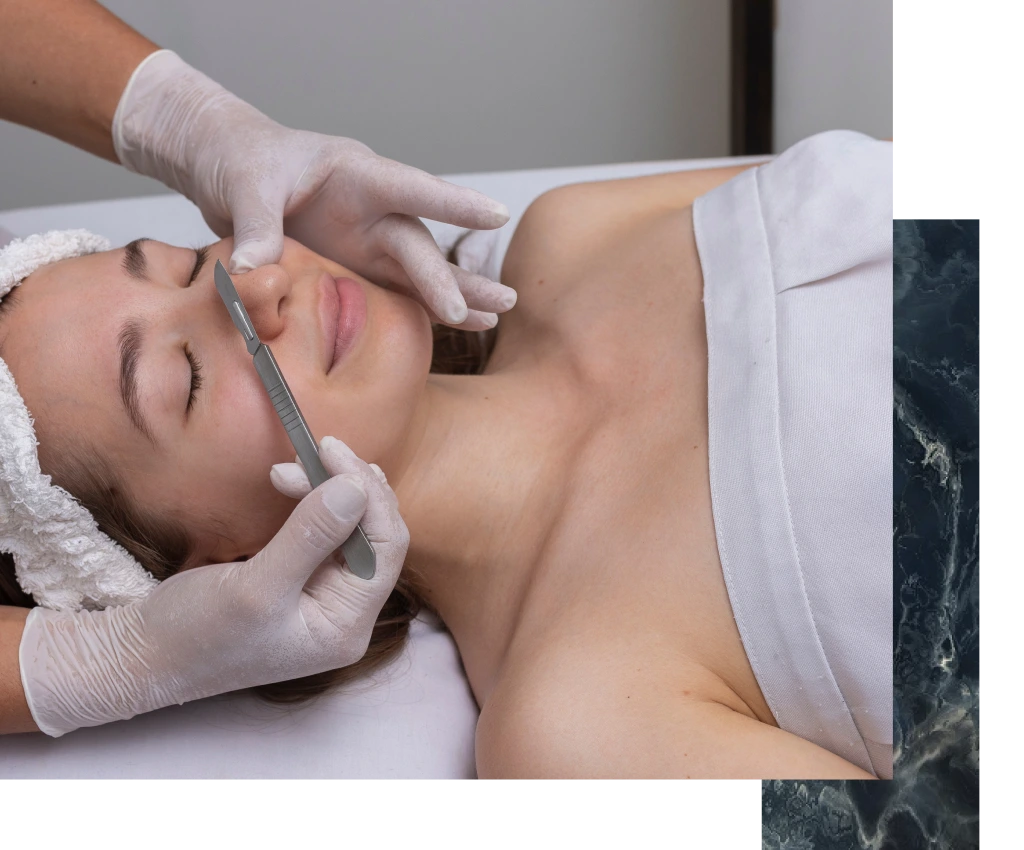 Clinician performing dermaplaning on a patient's face with a specialized blade