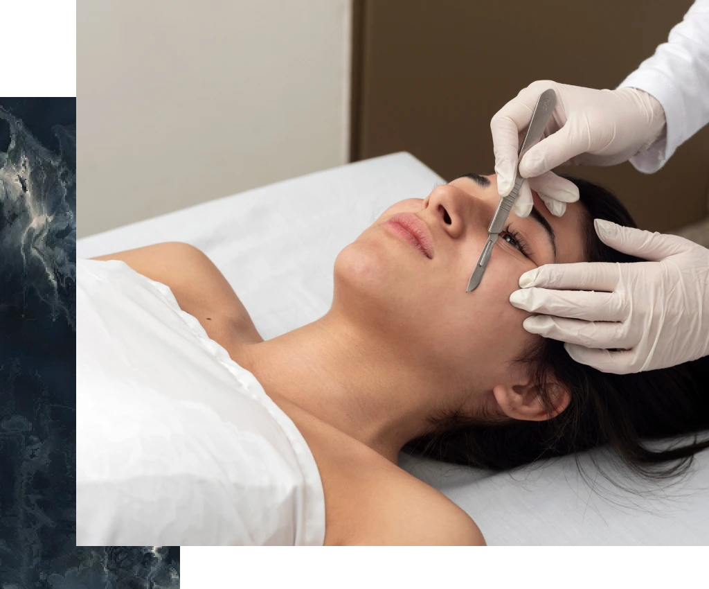 Clinician performing dermaplaning on a patient's face with a specialized blade