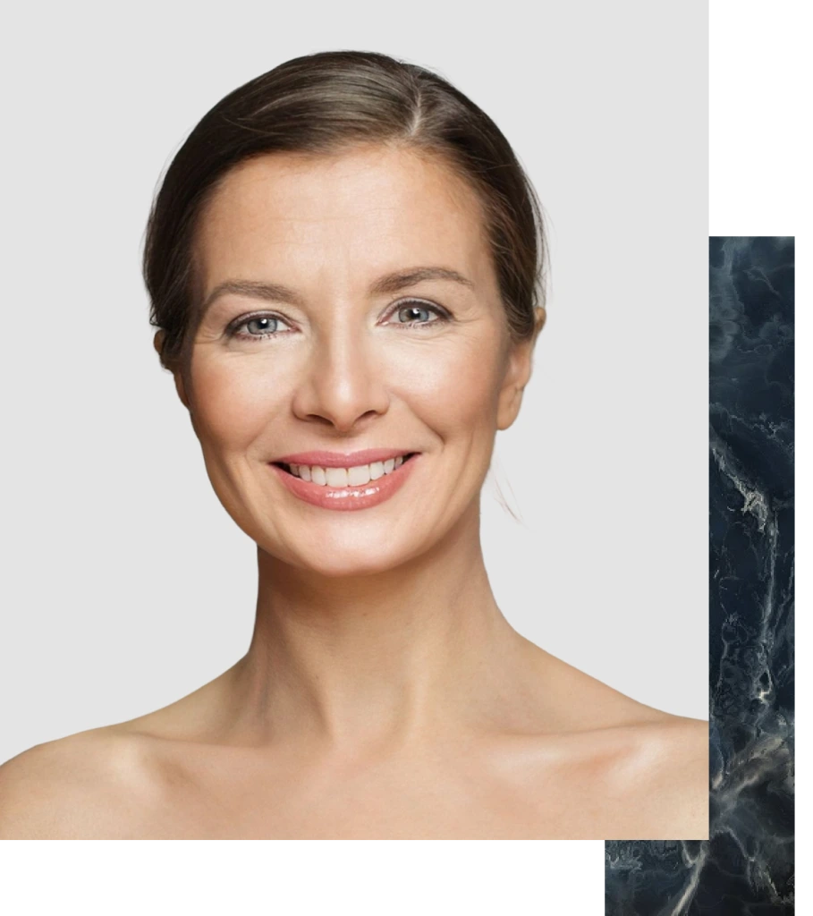 Woman with defined cheekbones smiling at camera, demonstrating buccal fat removal results