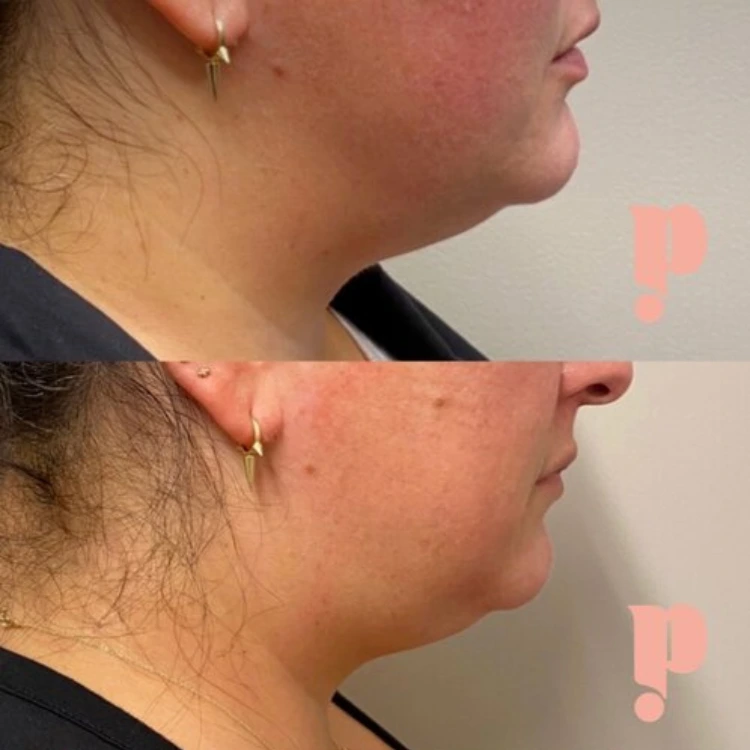 Untitled design - 2025-01-28T220644.775