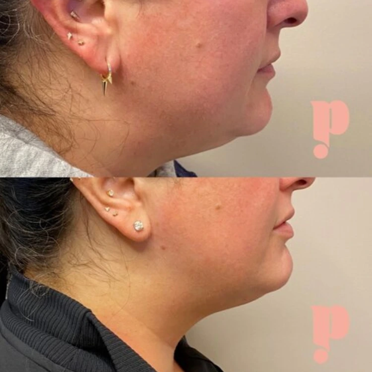 Untitled design - 2025-01-28T220714.309