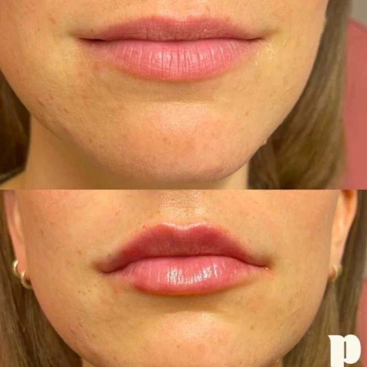 Untitled design - 2025-01-28T173826.751