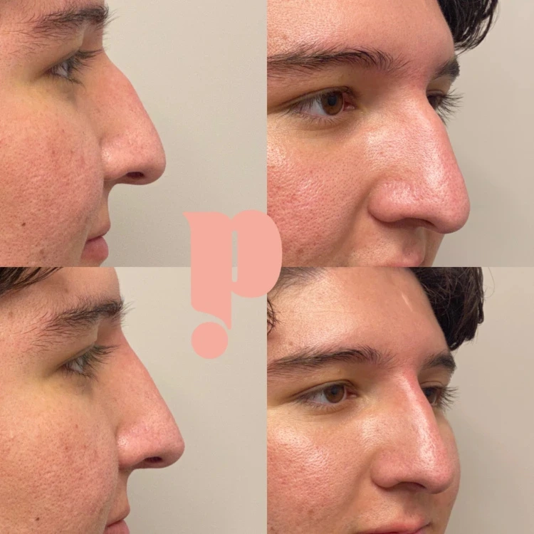 Untitled design - 2025-01-28T214020.434