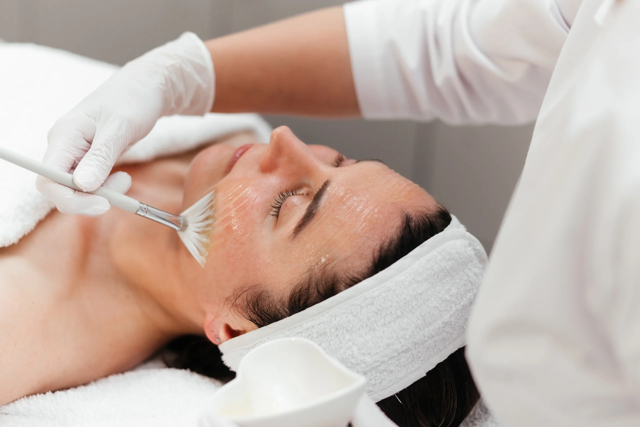Chemical Peels vs Microneedling: Differences, Benefits, and Results