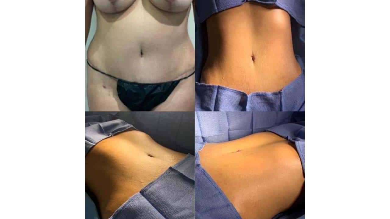 Ab Silhouetch Female.pptx 96