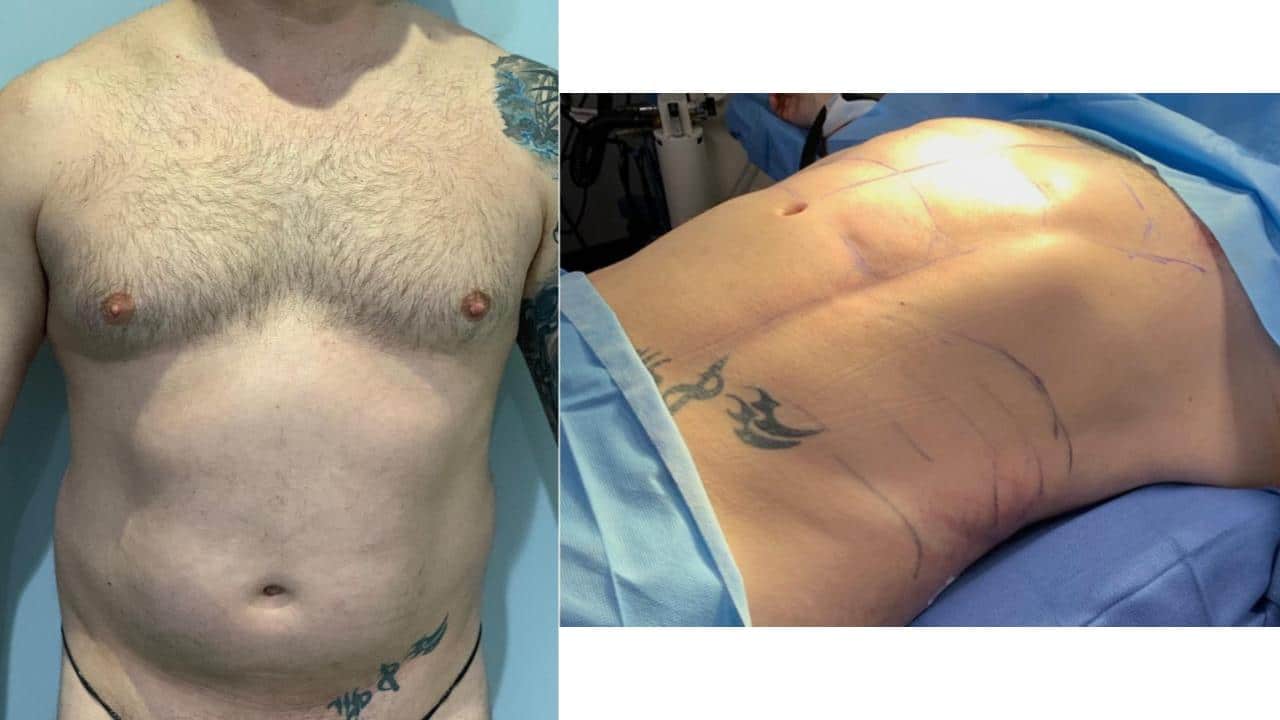 Ab Silhouetch Male.pptx 58