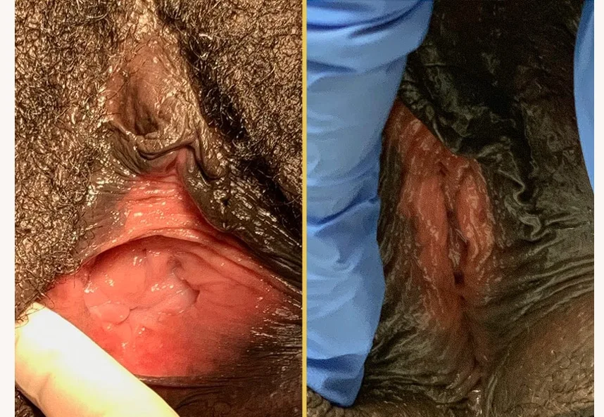 Case 257 1